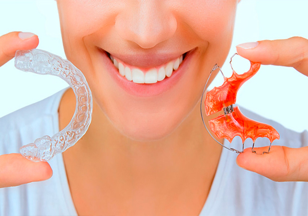 Retainer braces deals